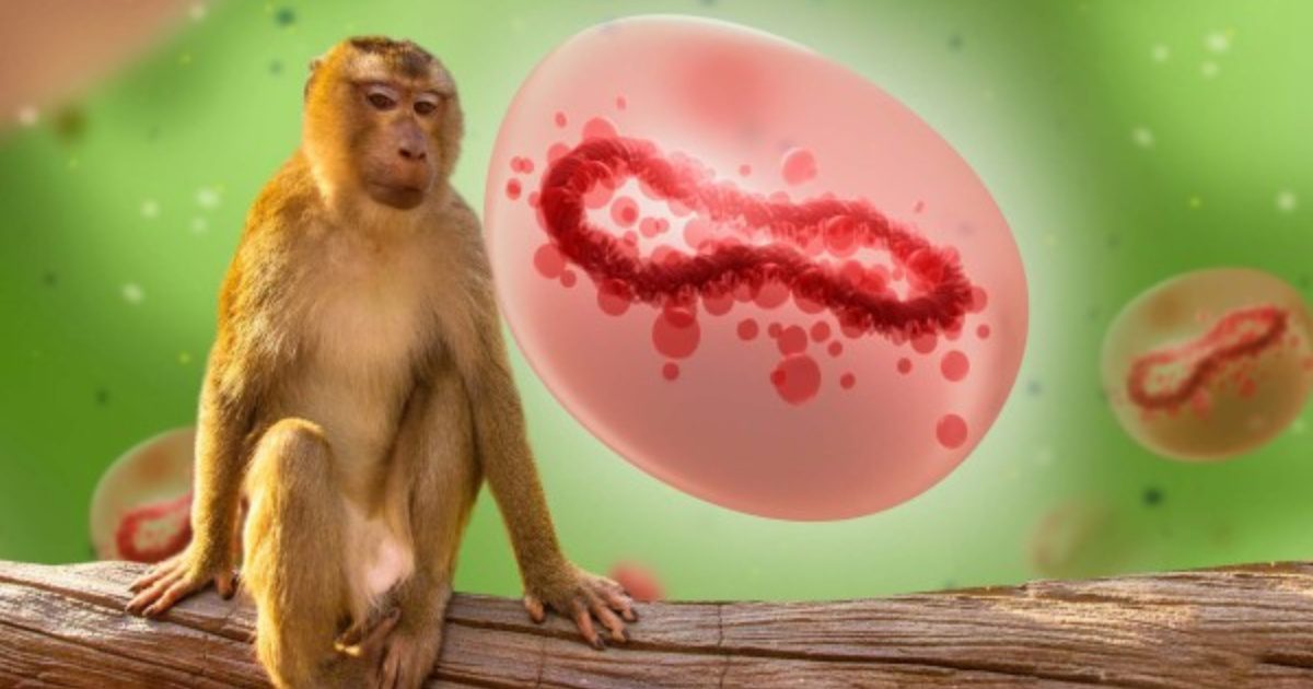 México alcanza los 147 casos confirmados de viruela de mono